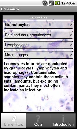 Urinemicro